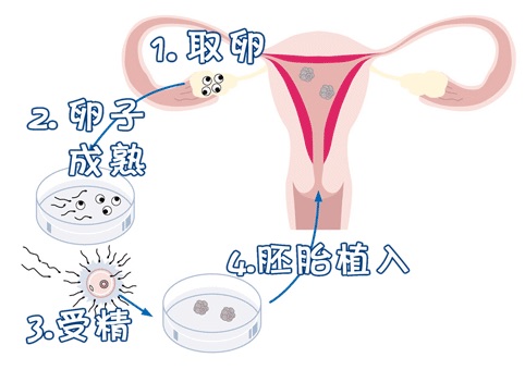 42岁二胎